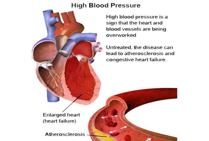 does grapefruit lower blood pressure naturally