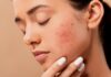 Best Beauty Tips: Home Remedies to Make Skin Shiny Skin care tips