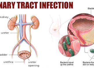 Urinary Track Infection