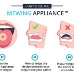 Mewing: What is it Exactly and How Does it Work? Mewing