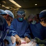 Human Kidney Transplantation from Pigs has been Accomplished in US Human Kidney Transplantation