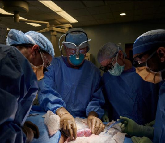 Human Kidney Transplantation from Pigs has been Accomplished in US Human Kidney Transplantation