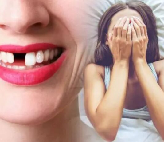 Dreaming about your Teeth Falling Out