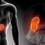 Protect Your Kidneys by Avoiding These Everyday Habits Habits that Harm Your Kidneys